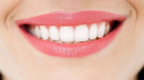 Cách bảo vệ răng sau khi lấy tủy
