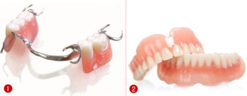 Ưu nhược điểm của các phương pháp trồng răng giả?