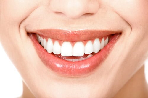 Niềng răng một hàm để chỉnh răng hô được không?