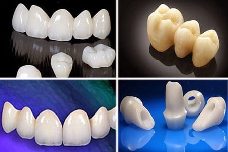 Răng sứ zirconia hiệu quả như thế nào? 2