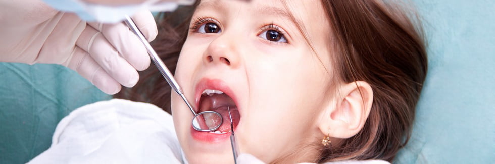 Tại sao nên lấy cao răng cho trẻ ?