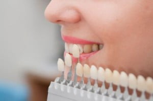 Chất tẩy trắng răng có làm hại men răng không? 