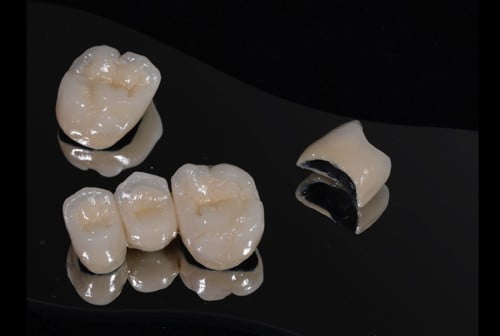 Độ bền của răng sứ thẫm mỹ