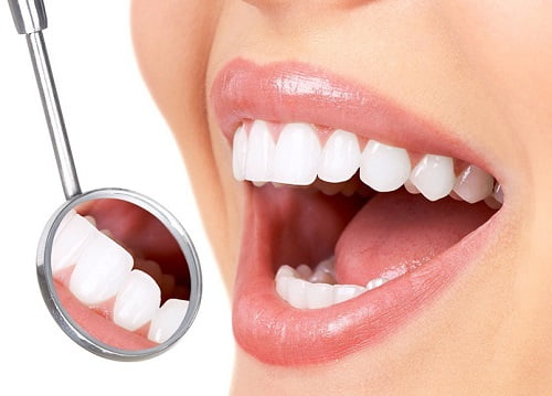 Độ bền của răng sứ thẫm mỹ