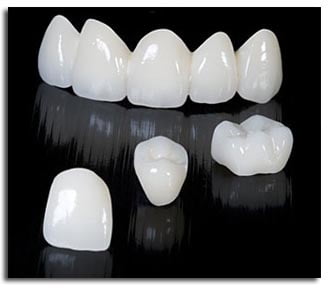 Bọc răng sứ thẩm mỹ có ưu điểm gì? Giải đáp nha khoa 2