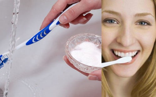 Bao lâu nên tẩy trắng răng một lần ?