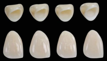 Răng sứ Zirconia có tính thẩm mỹ cao 2
