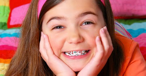 Niềng răng khểnh để bảo vệ sức khỏe răng miệng-2 Niềng răng khểnh để bảo vệ sức khỏe răng miệng