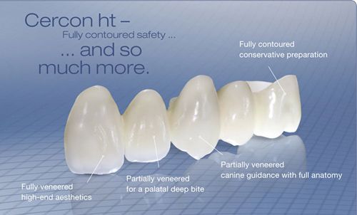 Mức giá bọc răng sứ Cercon 1