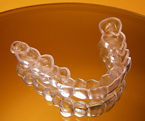 Niềng răng không mắc cài Invisalign