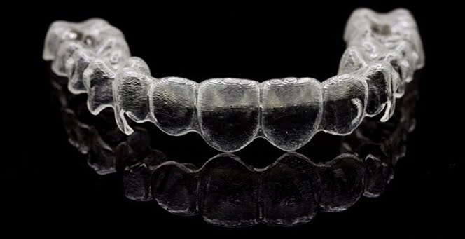 Niềng răng không mắc cài 3D Clear bao nhiêu?