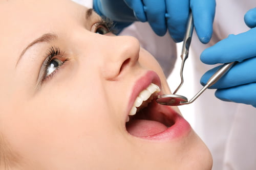 Sâu răng có nên cấy ghép Implant không 1