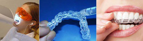 Tẩy trắng răng vĩnh viễn có được không? 2 Tẩy trắng răng vĩnh viễn có được không? 2