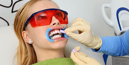 Làm thế nào để răng trắng sáng tự nhiên ? 3