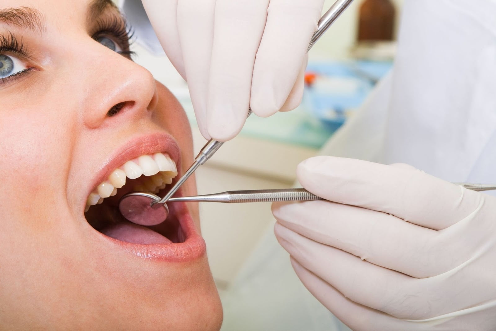 Tẩy trắng răng vĩnh viễn có được không? 4