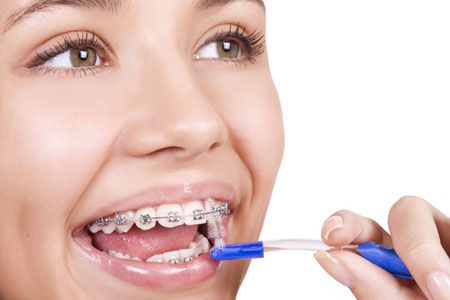 Sau khi niềng răng nên ăn gì? 4 Sau khi niềng răng nên ăn gì? 4