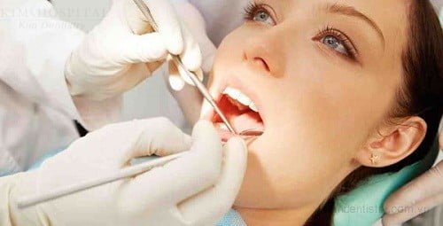Bọc răng sứ mất bao lâu thời gian? Bọc răng sứ mất bao lâu thời gian?
