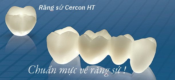 Thông tin hữu ích về bọc Răng sứ Cercon 