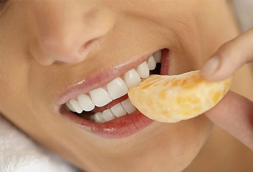 Răng sứ Veneer là gì?