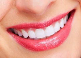 Chi phí trồng răng implant bao nhiêu là hợp lý ?