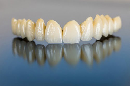 Răng sứ tồn tại trong thời gian bao lâu?