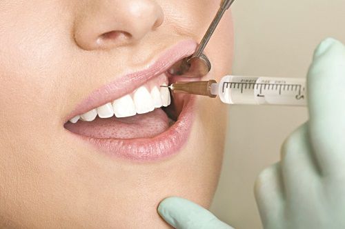 Nhổ răng khôn có đau không - Bí quyết nhổ răng an toàn 1
