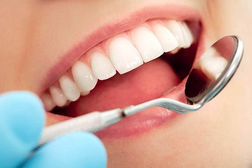 Nướu răng bị chảy máu phải làm sao? Nguyên nhân nướu răng bị chảy máu  3