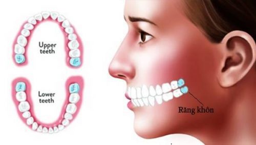 Răng khôn mọc ở vị trí nào trên hàm răng vĩnh viễn? 3