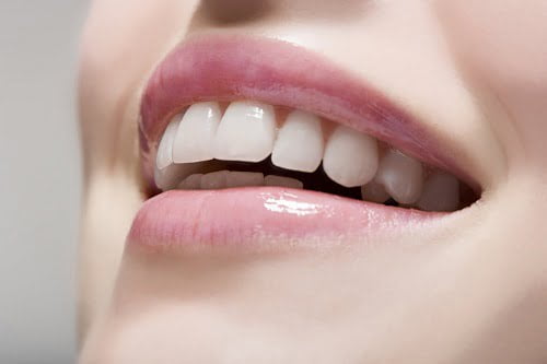 Bọc răng sứ bị cộm phải khắc phục như thế nào? 3