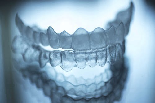 Mức chi phí trung bình niềng răng người lớn giá bao nhiêu tại các nha khoa?