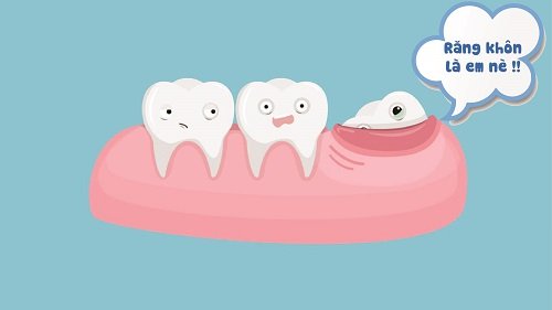 3 biểu hiện để biết răng khôn có mấy cái 3 3 biểu hiện để biết răng khôn có mấy cái 3