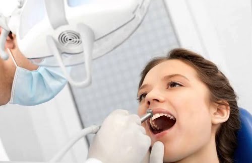 Công nghệ nha khoa mới - Cạo vôi răng siêu âm 2