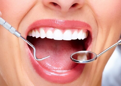 Thực hiện lấy cao răng có ảnh hưởng không? 1