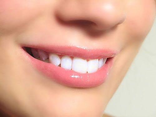 Trồng răng cửa hàm trên được thực hiện như thế nào? 3 Trồng răng cửa hàm trên được thực hiện như thế nào? 3