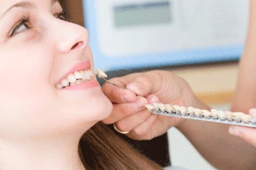Trồng răng khểnh có đau không? Chia sẻ thực tế từ khách hàng 2