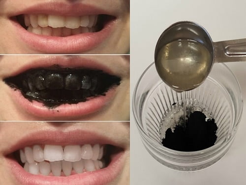Tẩy trắng răng bằng than củi đơn giản an toàn 3