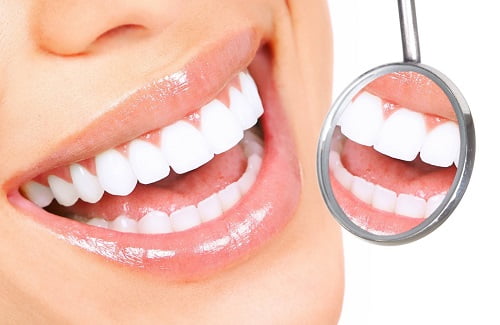 Tẩy trắng răng xong có được đánh răng không? Lý do 1