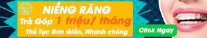 niềng răng trả góp không lãi suất