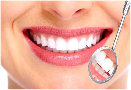 Làm răng sứ phải kiêng gì? 4 lưu ý bạn cần nắm 1