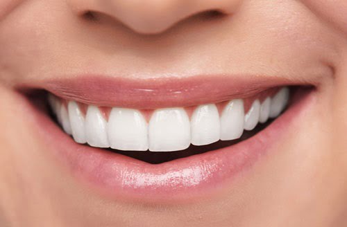 Làm răng sứ cả hàm áp dụng cho trường hợp nào? 1