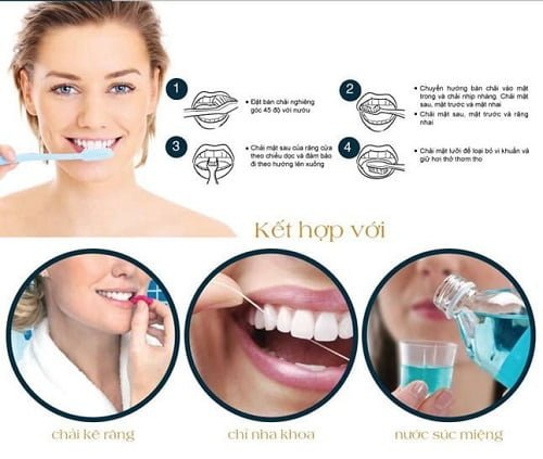 Làm răng sứ cả hàm áp dụng cho trường hợp nào? 4