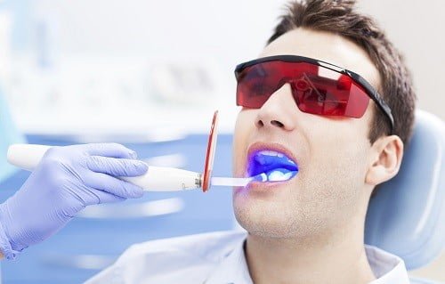 Tẩy trắng răng cho răng sâu có được không? Tham khảo 3