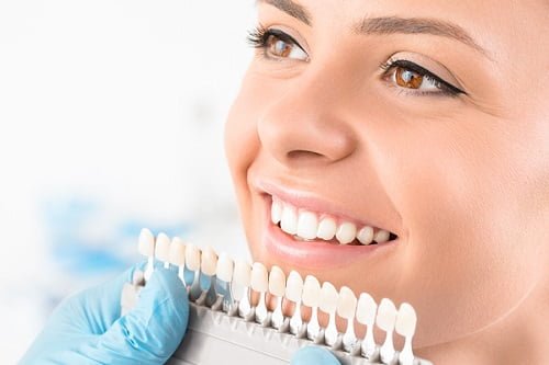 Trồng răng sứ không kim loại cần lưu ý gì? 2