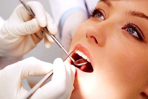 Lắp răng sứ bị sưng lợi phải làm sao? 3