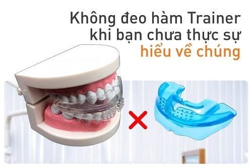 Dụng cụ niềng răng tại nhà có tốt không? 1